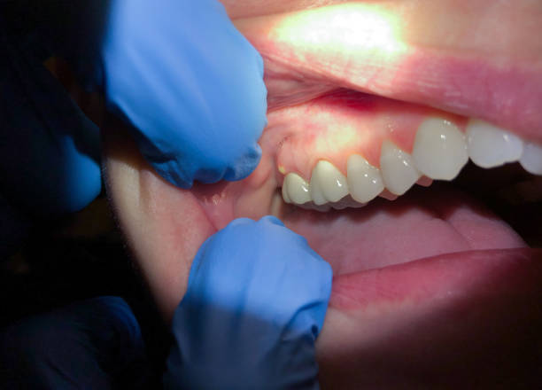 Best Orthodontic Emergency Dentist in Staunton, VA
