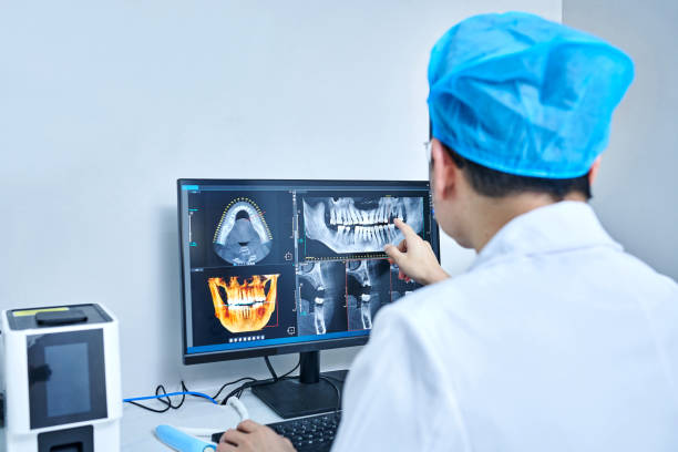 Best Emergency Dentist for Lost Fillings or Crowns in Staunton, VA