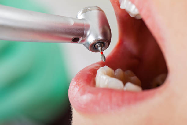 Best Weekend Emergency Dentist in Staunton, VA